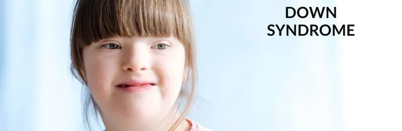 Understanding Down syndrome
